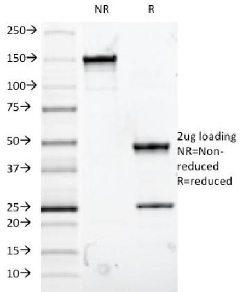 Anti-MUC5AC (Mucin 5AC / Gastric Mucin) Monoclonal Antibody(Clone: 9-13M1)