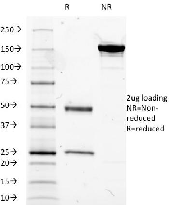 Anti-MUC5AC (Mucin 5AC / Gastric Mucin) Monoclonal Antibody(Clone: 2-11M1)