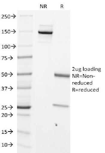 Anti-c-Myc Oncoprotein Monoclonal Antibody(Clone: MYC699)