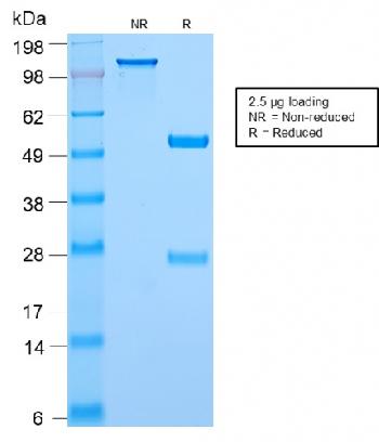 Anti-c-Myc Oncoprotein Monoclonal Antibody(Clone: MYC2895R)