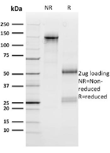 Anti-n-Myc (Neuroblastoma Marker) Monoclonal Antibody(Clone: NMYC-1)