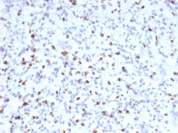 Anti-Myogenin / Myf-4 (Skeletal Muscle Marker) Monoclonal Antibody(Clone: MYOG/2660)