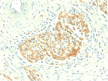 Anti-CD56 / NCAM1 / NKH1 (Neuronal Cell Marker) Monoclonal Antibody(Clone: NCAM1/2217R)