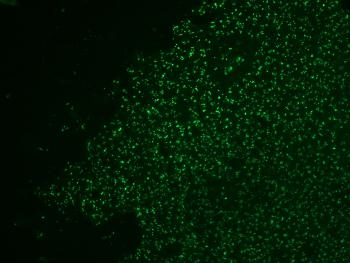 Anti-Nucleolin (Marker of Human Cells) Monoclonal Antibody(Clone: NCL/902)-CF488