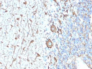 Anti-Neurofilament (NF-H) (Neuronal Marker) Monoclonal Antibody(Clone: NEFL.H/2324R)