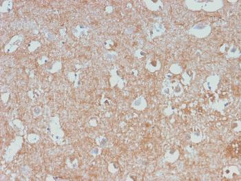 Anti-Neurofilament (NF-L) (Neuronal Marker) Monoclonal Antibody(Clone: NEFL/2983R)