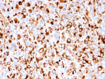 Anti-NGF-Receptor (p75) / CD271 (Soft Tissue Tumor Marker) Monoclonal Antibody(Clone: rNGFR/1965)