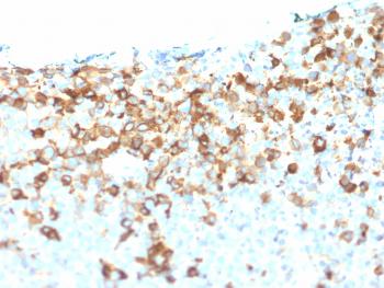 Anti-NGF-Receptor (p75) / CD271 (Soft Tissue Tumor Marker) Monoclonal Antibody(Clone: NGFR/1964)