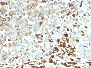 Anti-NGF-Receptor (p75) / CD271 (Soft Tissue Tumor Marker) Monoclonal Antibody(Clone: NGFR/2550R)