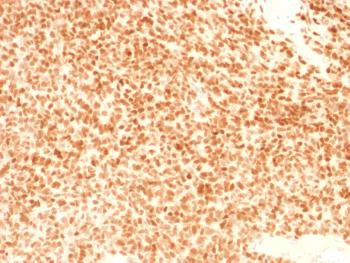 Anti-NKX2.2 (Neuroendocrine & Ewing's Sarcoma Marker) Monoclonal Antibody(Clone: NX2/1524)