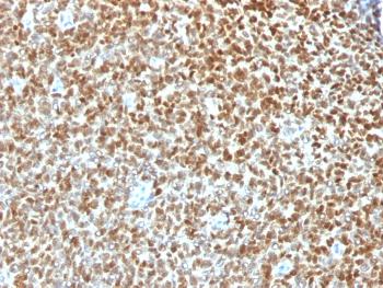 Anti-NKX2.2 (Neuroendocrine & Ewing's Sarcoma Marker) Monoclonal Antibody(Clone: NX2/1422R)