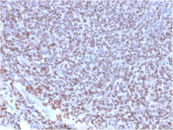 Anti-NKX2.2 (Neuroendocrine & Ewing's Sarcoma Marker) Monoclonal Antibody(Clone: NX2/2198R)