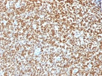 Anti-NKX2.2 (Neuroendocrine & Ewing's Sarcoma Marker) Polyclonal Antibody