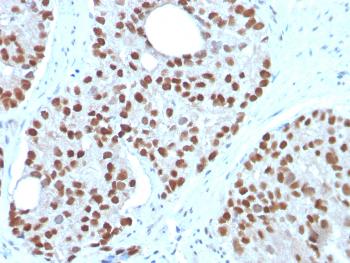 Anti-NKX3.1 (Metastatic Prostate Adenocarcinoma Marker) Monoclonal Antibody(Clone: NKX3.1/3350)