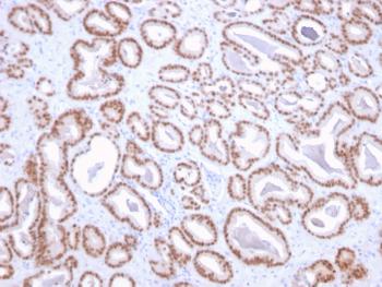 Anti-NKX3.1 (Metastatic Prostate Adenocarcinoma Marker) Monoclonal Antibody(Clone: NKX3.1/2836)