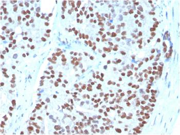 Anti-NKX3.1 (Metastatic Prostate Adenocarcinoma Marker) Monoclonal Antibody(Clone: NKX3.1/3348)