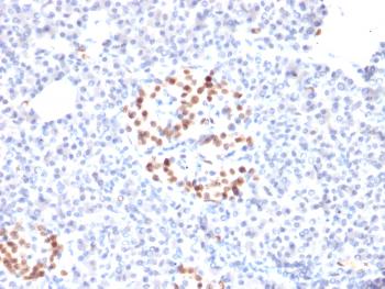 Anti-NKX6.1 (Marker for Pancreatic and Duodenal Neuroendocrine Tumors) Monoclonal Antibody(Clone: NKX61/2561)