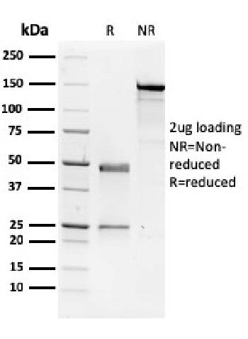 Anti-NME1 / nm23-H1 / NDPK-A (Suppressor of Metastasis) Monoclonal Antibody(Clone: CPTC-NME1-2)