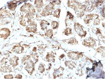 Anti-NME2 / nm23-H2 / NDPK-B (Suppressor of Metastasis) Monoclonal Antibody(Clone: CPTC-NME2-2)