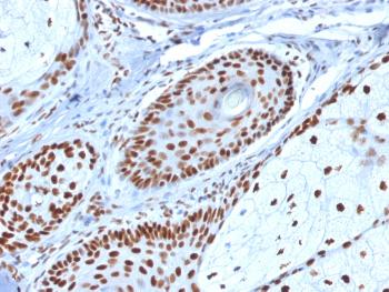 Anti-Nucleophosmin (Acute Myeloid Leukemia Marker) Monoclonal Antibody(Clone: NPM1/1902)