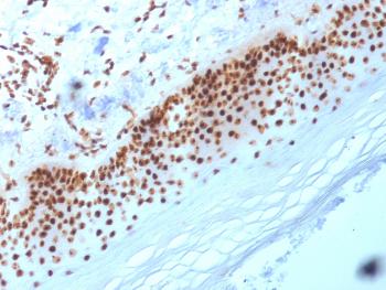 Anti-Nucleophosmin (Acute Myeloid Leukemia Marker) Monoclonal Antibody(Clone: NA24)