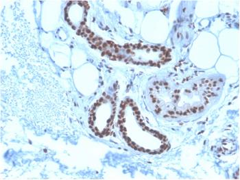 Anti-Nucleophosmin (Acute Myeloid Leukemia Marker) Monoclonal Antibody(Clone: NPM1/3285)