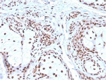 Anti-Nucleophosmin (Acute Myeloid Leukemia Marker) Monoclonal Antibody(Clone: NPM1/3286)