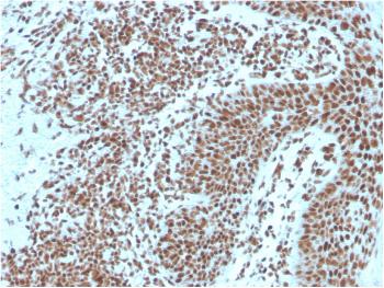 Anti-Nucleophosmin (Acute Myeloid Leukemia Marker) Monoclonal Antibody(Clone: NPM1/3287)