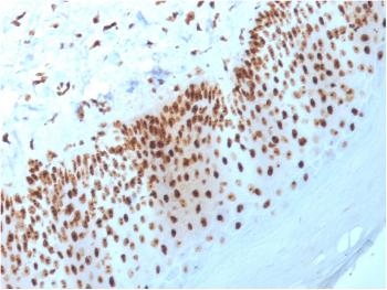 Anti-Nucleophosmin (Acute Myeloid Leukemia Marker) Monoclonal Antibody(Clone: NPM1/3398)