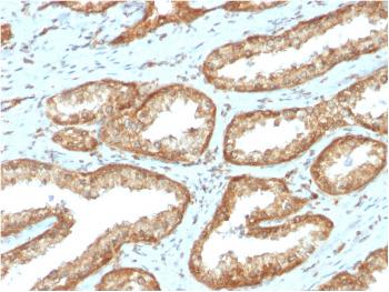 Anti-YBX1 / Y-box Binding Protein 1 / YB-1 (Tumor Biomarker) Monoclonal Antibody(Clone: YBX1/2430)