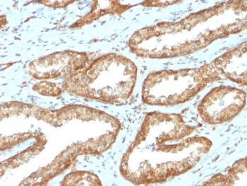 Anti-YBX1 / Y-box Binding Protein 1 / YB-1 (Tumor Biomarker) Monoclonal Antibody(Clone: rYBX1/2430)