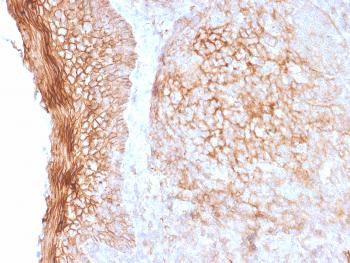 Anti-CD73 (Immuno-Oncology Target) Monoclonal Antibody(Clone: NT5E/2505)