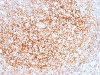 Anti-CD73 (Immuno-Oncology Target) Monoclonal Antibody(Clone: NT5E/2545)