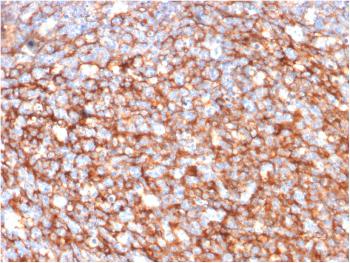 Anti-CD73 (Immuno-Oncology Target) Monoclonal Antibody(Clone: NT5E/2646)