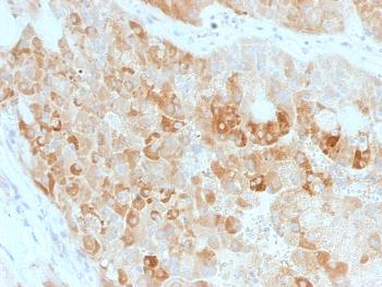 Anti-ROR2 Monoclonal Antibody(Clone: ROR2/1911)