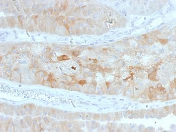 Anti-ROR2 Monoclonal Antibody(Clone: ROR2/1912)