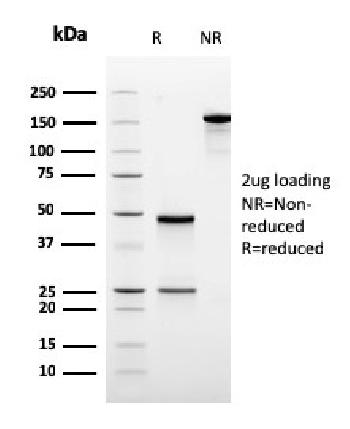 Anti-Ornithine Decarboxylase-1 (ODC-1) Monoclonal Antibody(Clone: rODC1/485)