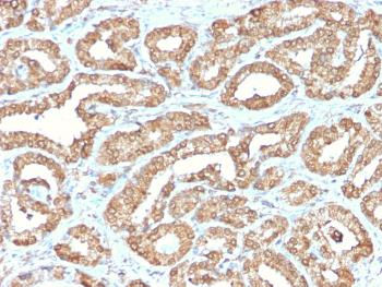 Anti-Ornithine Decarboxylase-1 (ODC-1) Monoclonal Antibody(Clone: ODC1/2878R)