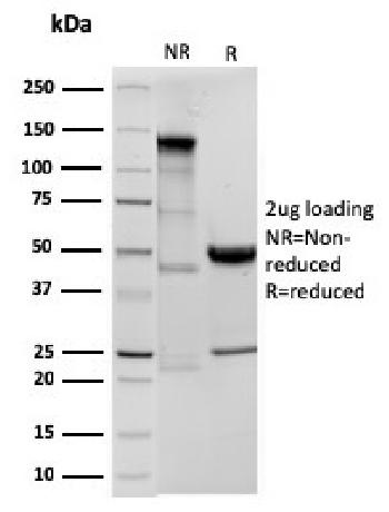 Anti-Ornithine Decarboxylase-1 (ODC-1) Monoclonal Antibody(Clone: ODC1/3636R)