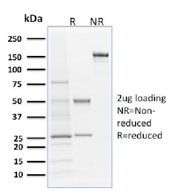 Anti-Langerin / CD207 (Marker of Langerhans Cells) Monoclonal Antibody(Clone: LGRN/1821)