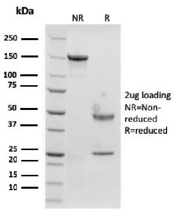 Anti-Langerin / CD207 (Marker of Langerhans Cells) Monoclonal Antibody(Clone: rLGRN/1821)