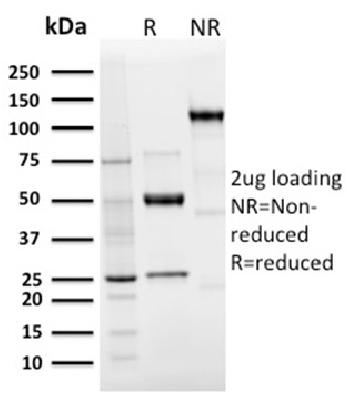 Anti-Langerin / CD207 (Marker of Langerhans Cells) Monoclonal Antibody(Clone: LGRN/3136R)