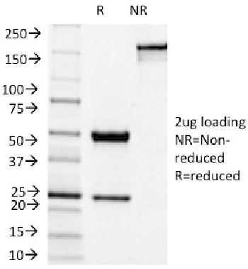 Anti-NOX4 / NADPH Oxidase 4 Monoclonal Antibody(Clone: NOX4/1245)