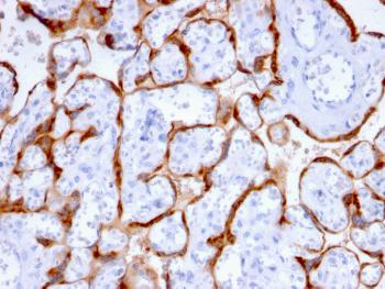 Anti-PAPP-A / Pappalysin-1 (Marker of Atherosclerosis and Aneuploid Fetus) Monoclonal Antibody(Clone: PAPPA/2715)