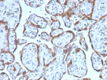 Anti-PAPP-A / Pappalysin-1 (Marker of Atherosclerosis and Aneuploid Fetus) Monoclonal Antibody(Clone: PAPPA/2717)