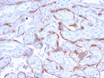 Anti-PAPP-A / Pappalysin-1 (Marker of Atherosclerosis and Aneuploid Fetus) Monoclonal Antibody(Clone: PAPPA/2718)