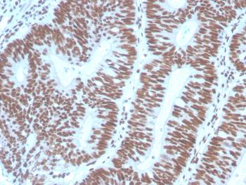 Anti-PAX2 (Renal Cell & Ovarian Carcinoma Marker) Monoclonal Antibody(Clone: PAX2/1104)