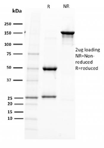 Anti-PAX5 / BSAP (Early B-Cell Marker) Monoclonal Antibody(Clone: PAX5/2595)