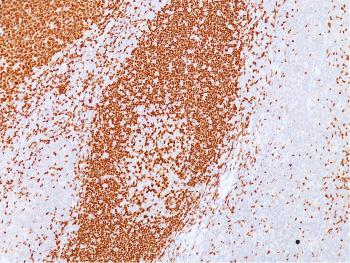 Anti-PAX5 / BSAP (Early B-Cell Marker) Monoclonal Antibody(Clone: PAX5/3735)