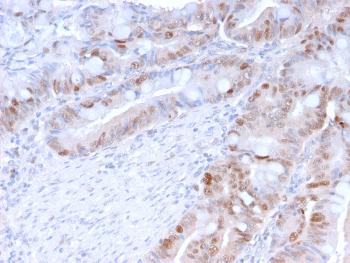 Anti-PCNA (Proliferating Cell Nuclear Antigen) (G1- & S-phase Marker) Monoclonal Antibody(Clone: PC5)